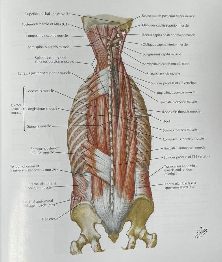 This image shows the paraspinal muscles that run along the spine and down the back.