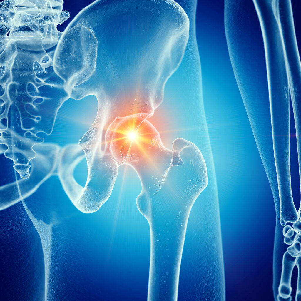 Snapping Hip Syndrome Exercises: Fix the Click | Mobility-Doc