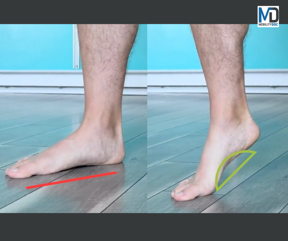 A test demonstration of how you can tell if you have rigid flat feet