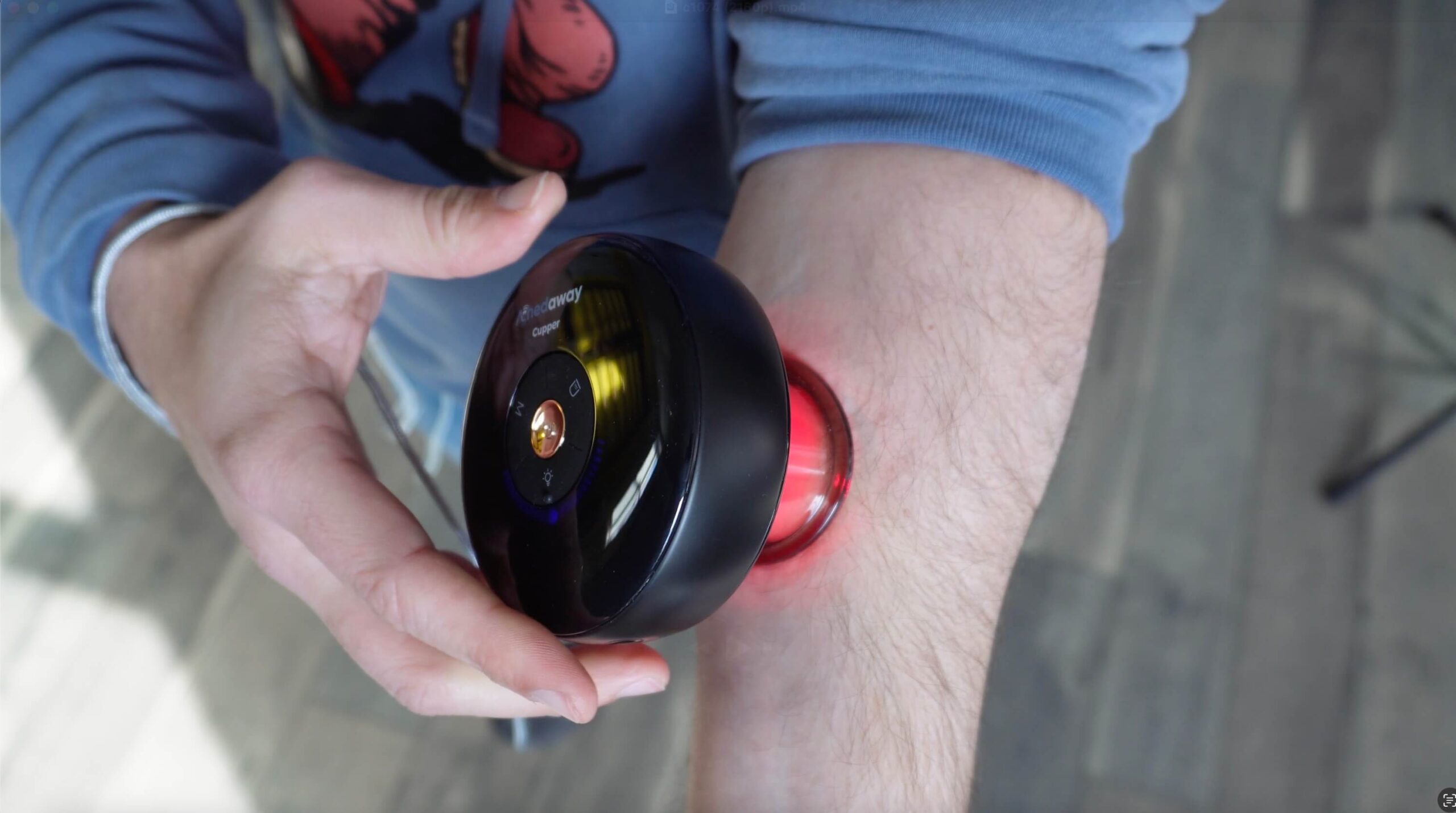 The Achedaway Cupper: Modern Ancient Medicine | Mobility-Doc